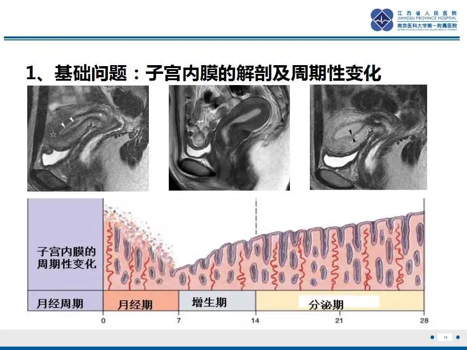 影像PPT - 【PPT】子宫腺肉瘤-11