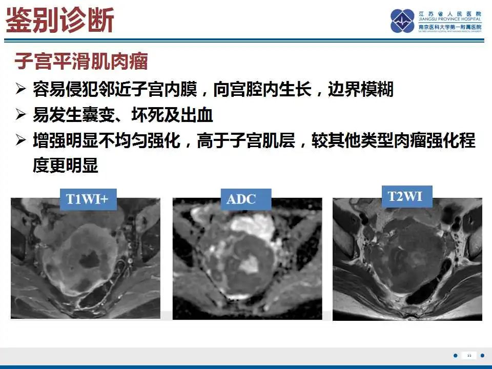 影像PPT - 【PPT】子宫腺肉瘤-34