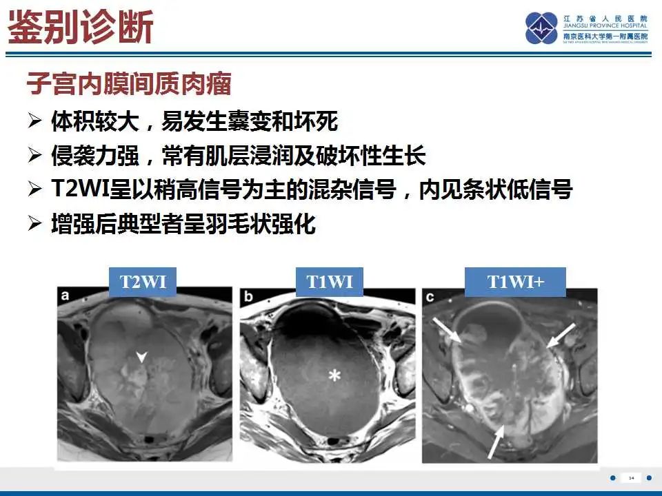 影像PPT - 【PPT】子宫腺肉瘤-35