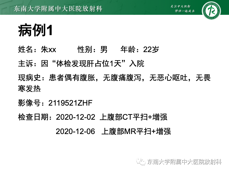 影像PPT - 【PPT】肝脏局灶性结节增生-3