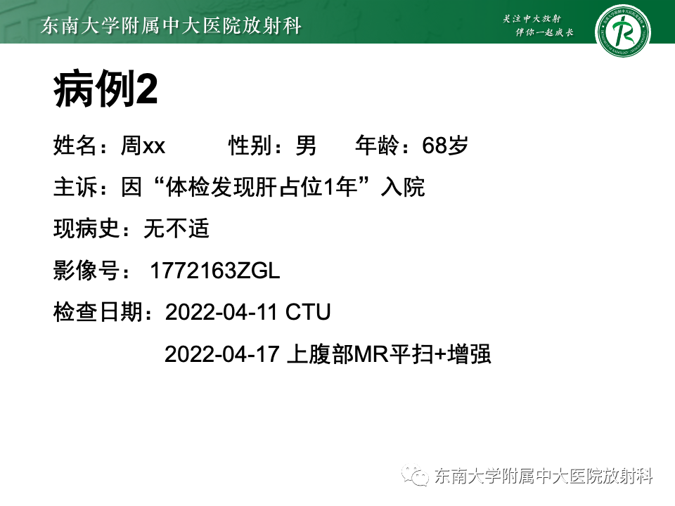 影像PPT - 【PPT】肝脏局灶性结节增生-15