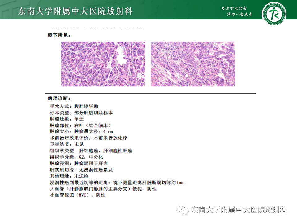 影像PPT - 【PPT】肝脏局灶性结节增生-25