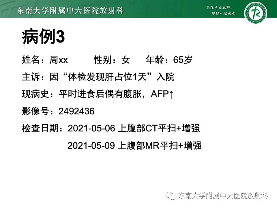 影像PPT - 【PPT】肝脏局灶性结节增生-23