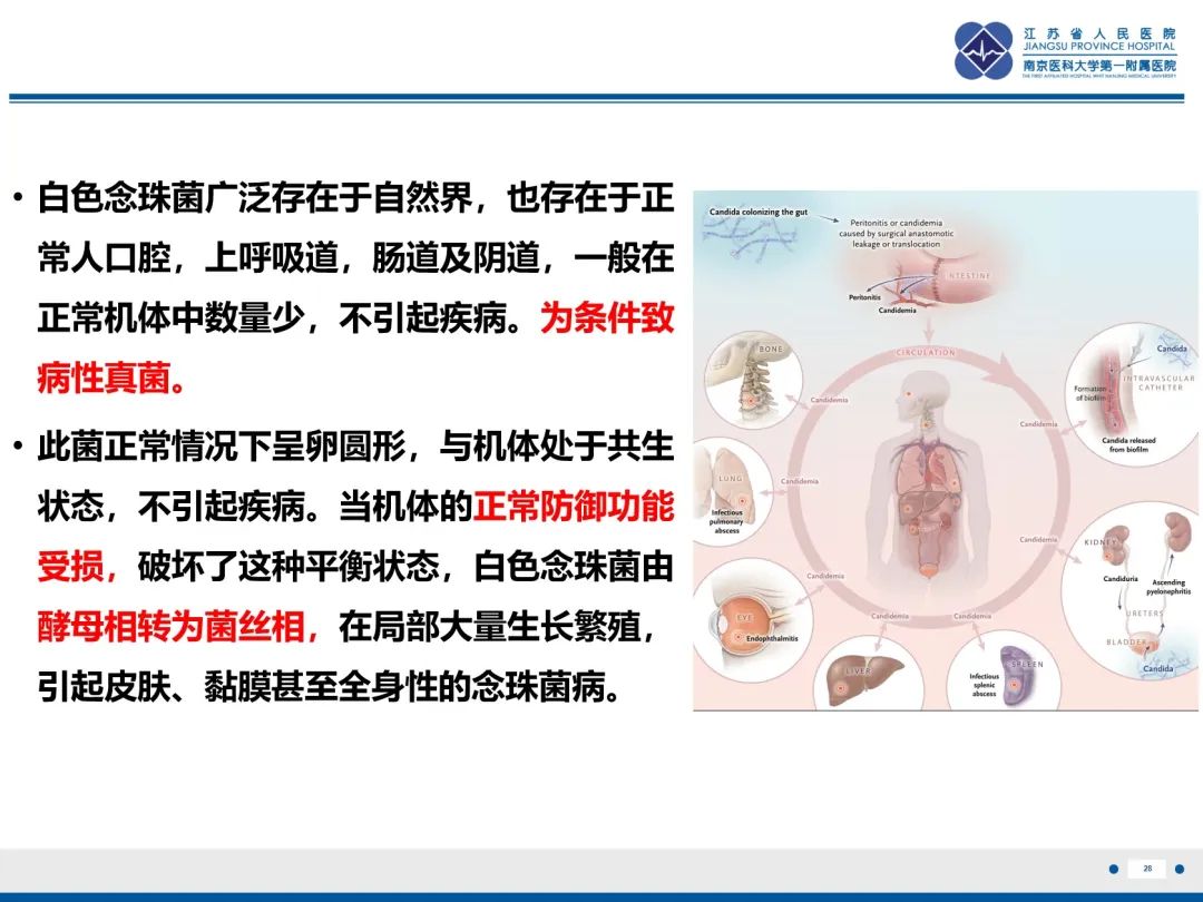 影像PPT - 【PPT】Baby\'s breath(满天星)​—新生儿侵袭性念珠菌病-29