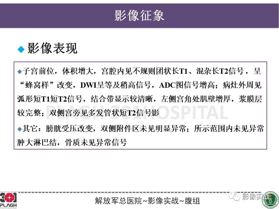 影像PPT - 【病例】葡萄胎1例MR影像-12