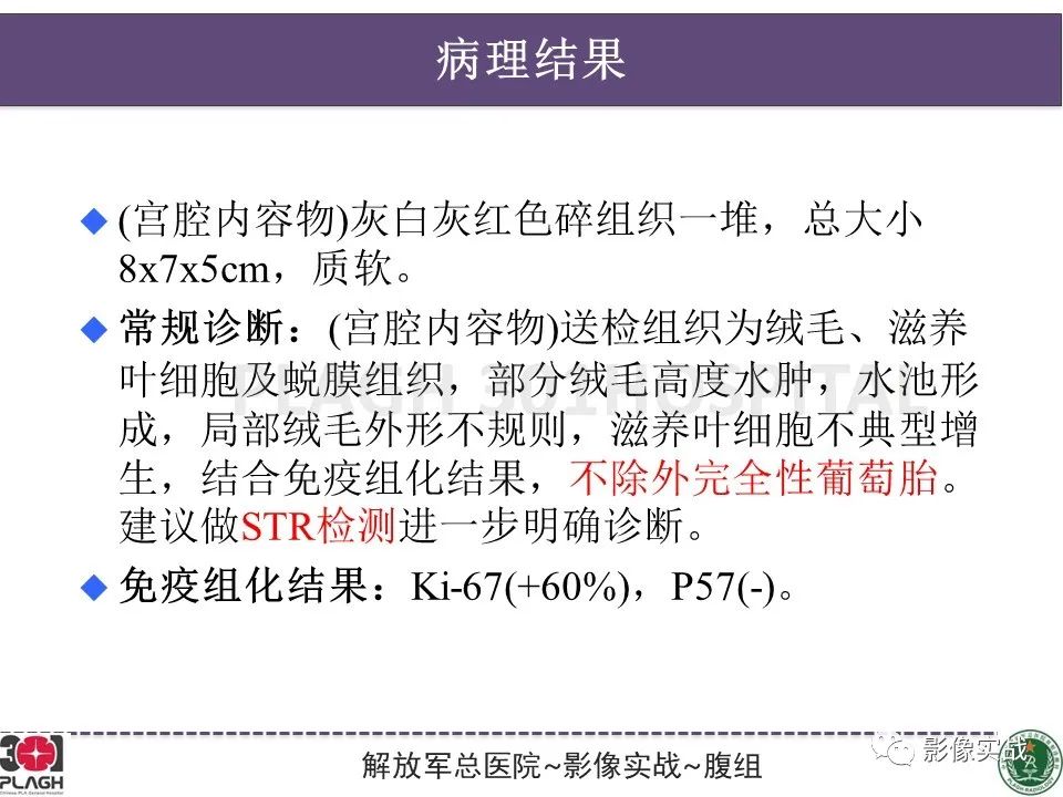 影像PPT - 【病例】葡萄胎1例MR影像-23