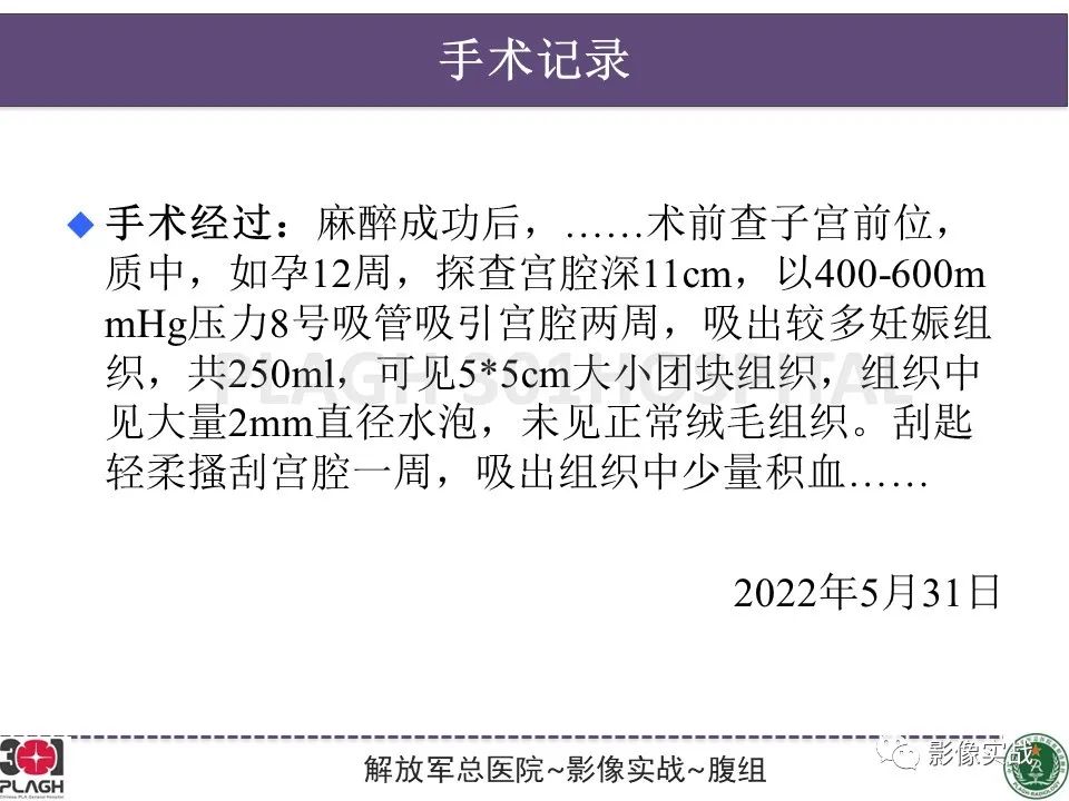 影像PPT - 【病例】葡萄胎1例MR影像-22