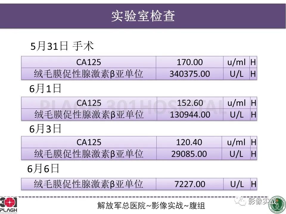 影像PPT - 【病例】葡萄胎1例MR影像-24