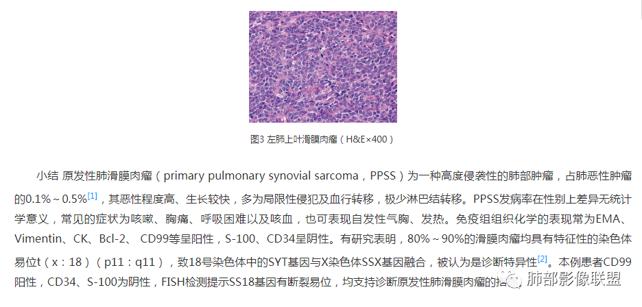 影像PPT - 【病例】罕见的肺滑膜肉瘤1例CT-16 影像PPT - 【病例】罕见的肺滑膜肉瘤1例CT-16