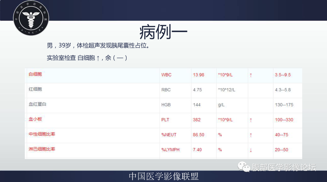 影像PPT - 【病例】胰腺异位副脾并上皮囊肿1例影像表现-3