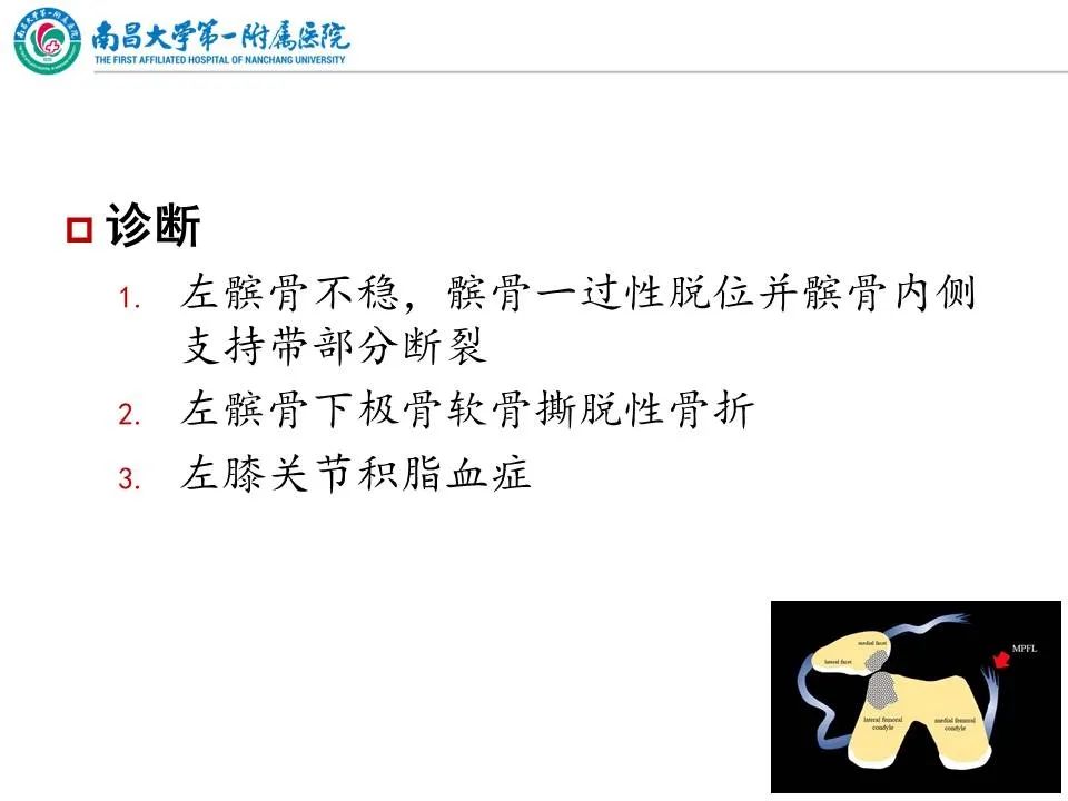 影像PPT - 【PPT】那些年可能错过的膝关节损伤-22