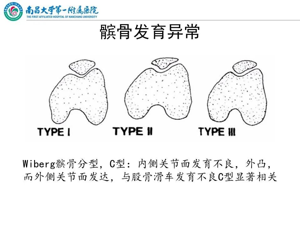 影像PPT - 【PPT】那些年可能错过的膝关节损伤-25