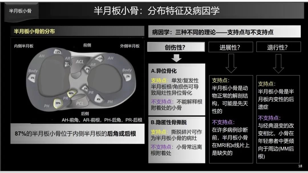 影像PPT - 【PPT】半月板根部,Ramp区,修复,及其后遗症-18 影像PPT - 【PPT】半月板根部,Ramp区,修复,及其后遗症-18