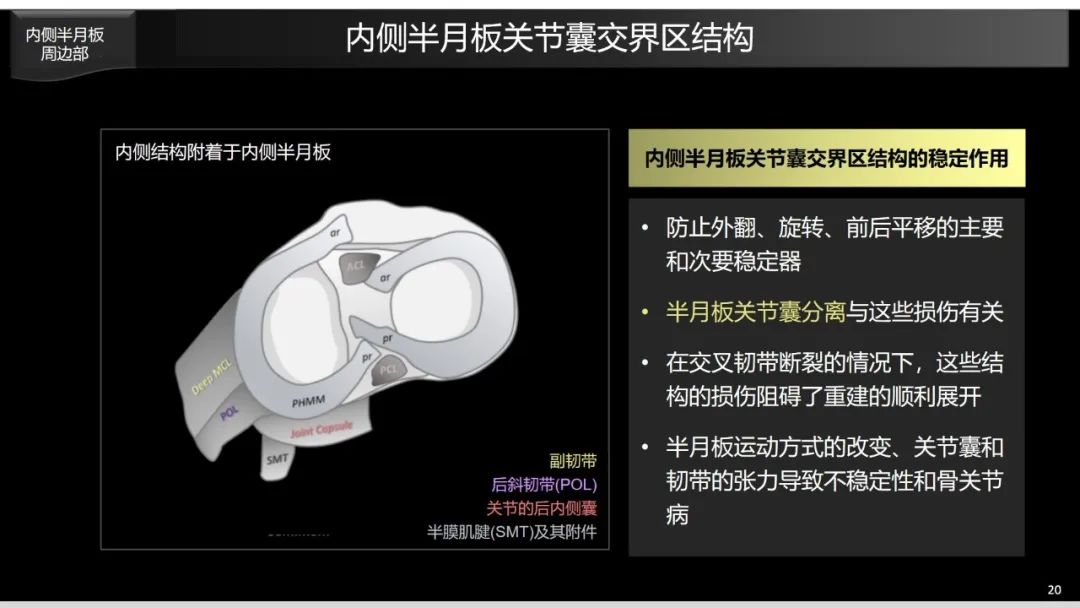 影像PPT - 【PPT】半月板根部,Ramp区,修复,及其后遗症-24 影像PPT - 【PPT】半月板根部,Ramp区,修复,及其后遗症-24