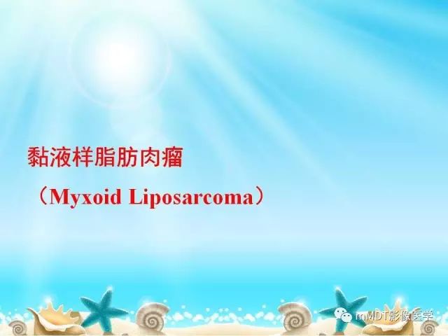 影像PPT - 【PPT】黏液样软组织肿瘤影像学-10