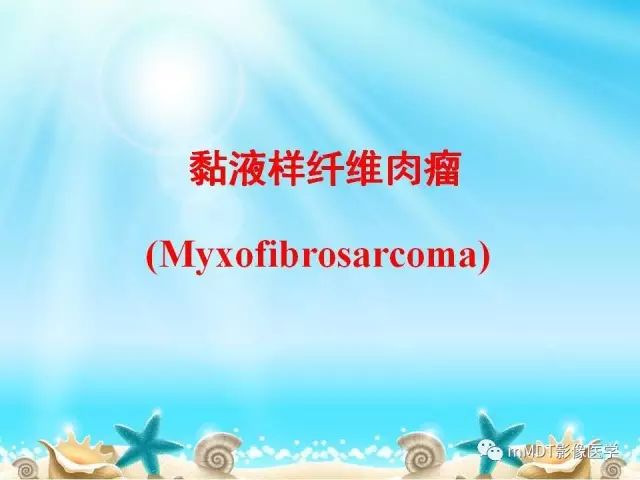 影像PPT - 【PPT】黏液样软组织肿瘤影像学-15
