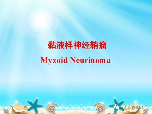 影像PPT - 【PPT】黏液样软组织肿瘤影像学-25
