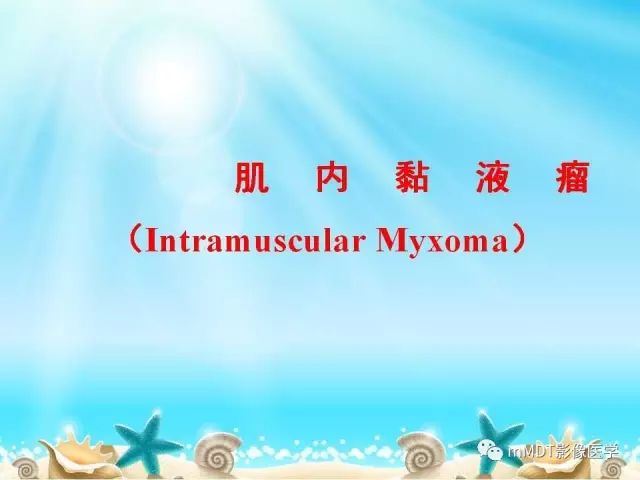 影像PPT - 【PPT】黏液样软组织肿瘤影像学-28