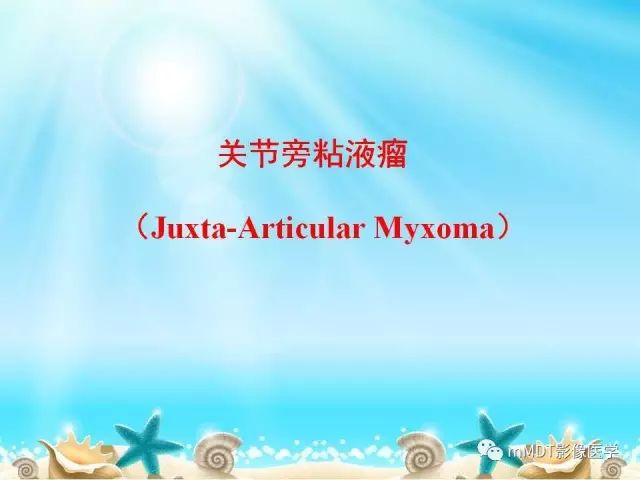 影像PPT - 【PPT】黏液样软组织肿瘤影像学-32