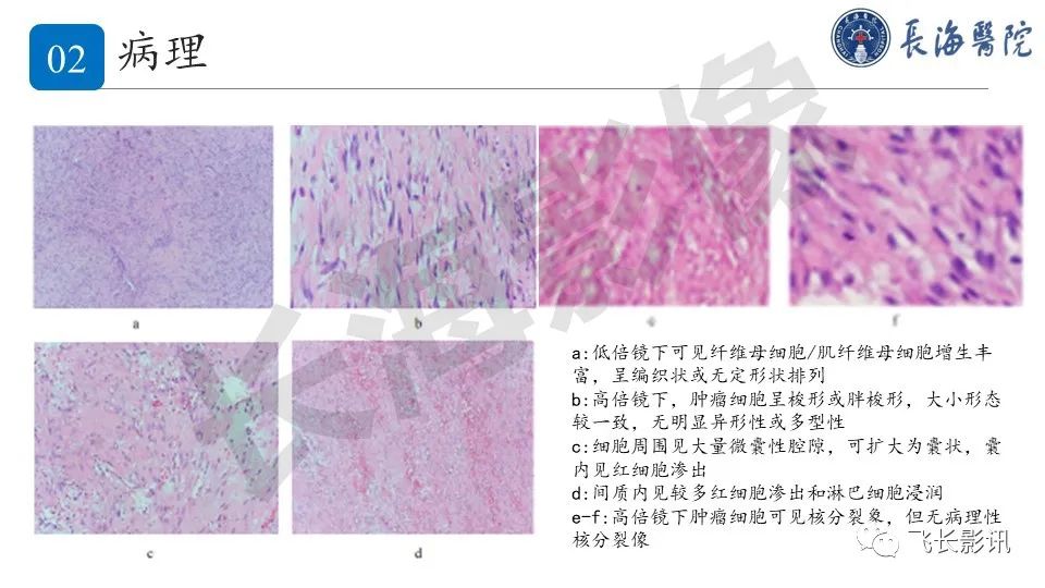 影像PPT - 【PPT】结节性筋膜炎-10