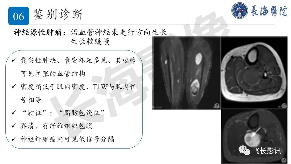 影像PPT - 【PPT】结节性筋膜炎-27