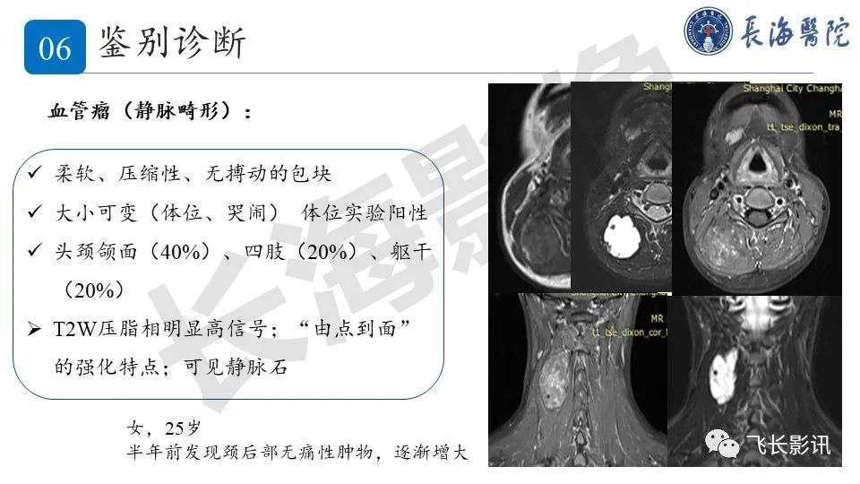 影像PPT - 【PPT】结节性筋膜炎-29
