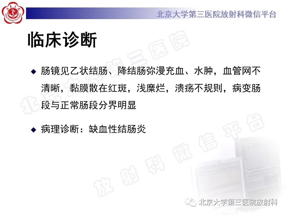影像PPT - 【PPT】缺血性肠炎-6