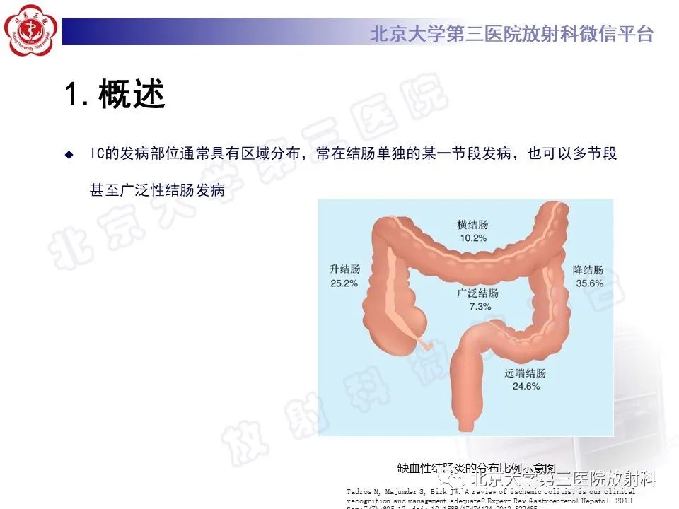 影像PPT - 【PPT】缺血性肠炎-11