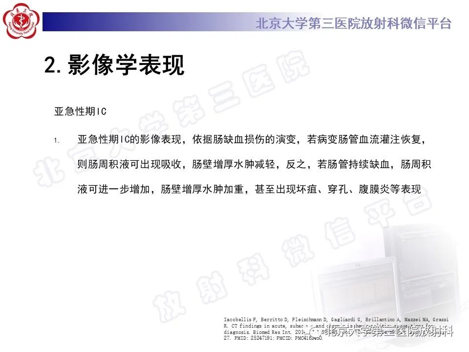 影像PPT - 【PPT】缺血性肠炎-17