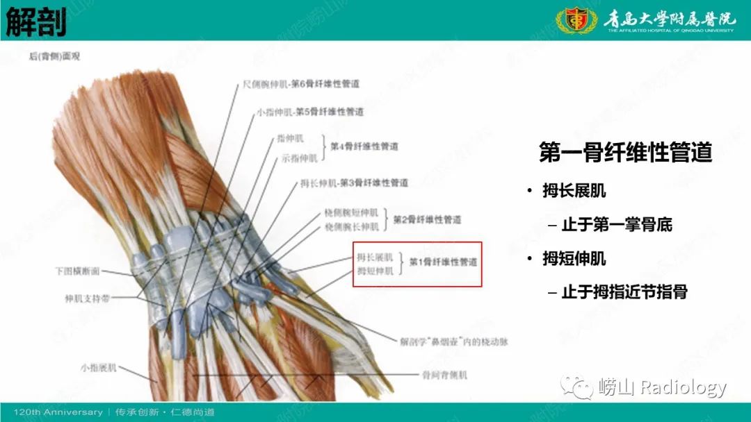 影像PPT - 【病例】桡骨茎突狭窄性腱鞘炎1例MR-13