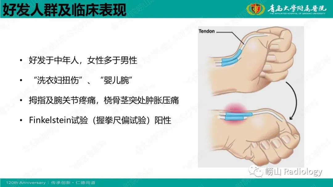 影像PPT - 【病例】桡骨茎突狭窄性腱鞘炎1例MR-12