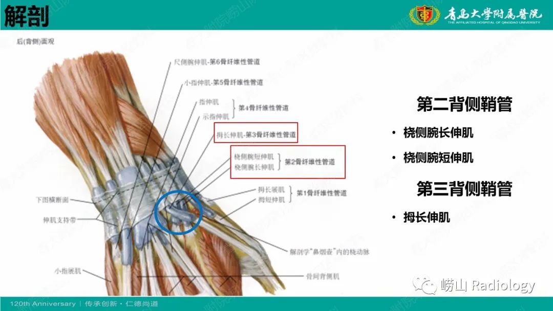 影像PPT - 【病例】桡骨茎突狭窄性腱鞘炎1例MR-22