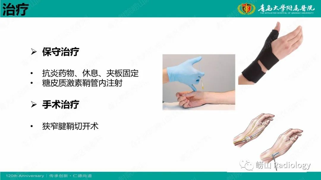 影像PPT - 【病例】桡骨茎突狭窄性腱鞘炎1例MR-19