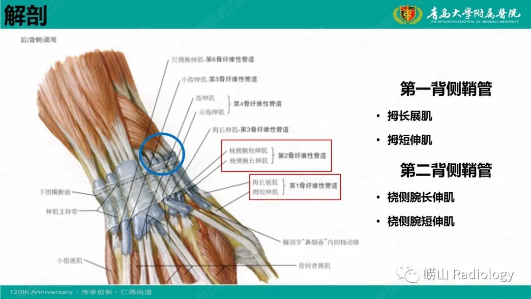 影像PPT - 【病例】桡骨茎突狭窄性腱鞘炎1例MR-27