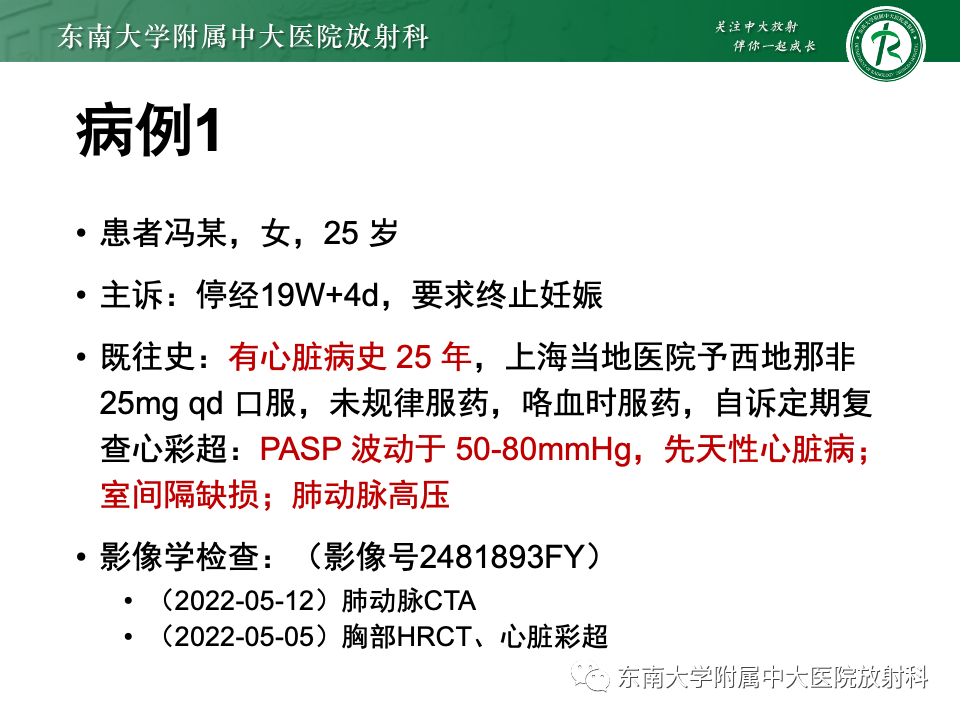 影像PPT - 【PPT】主动脉弓离断-4 影像PPT - 【PPT】主动脉弓离断-4