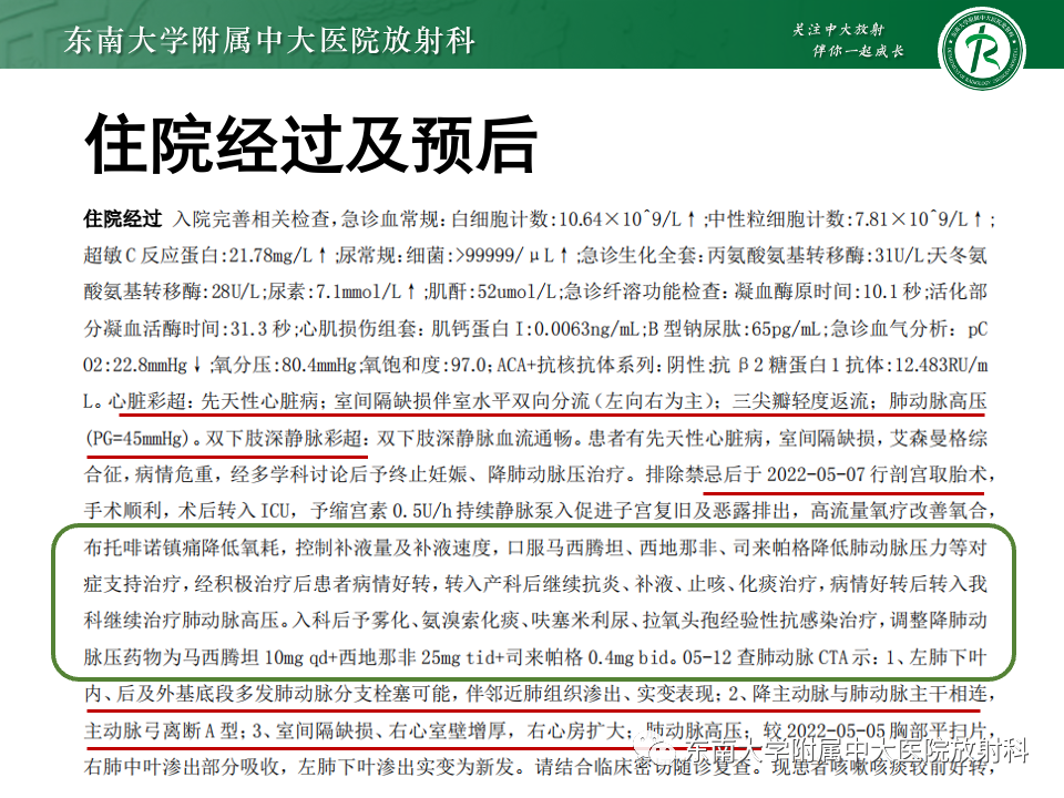 影像PPT - 【PPT】主动脉弓离断-8 影像PPT - 【PPT】主动脉弓离断-8