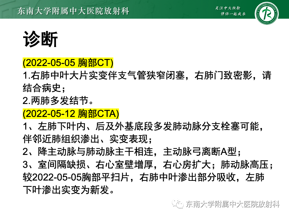 影像PPT - 【PPT】主动脉弓离断-7 影像PPT - 【PPT】主动脉弓离断-7