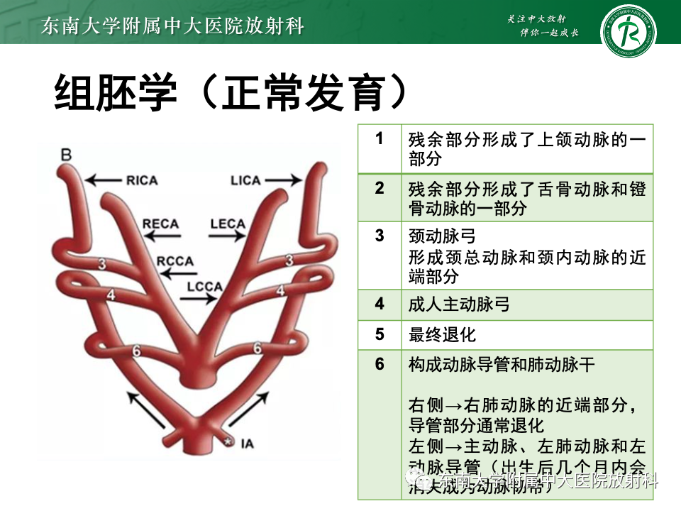 影像PPT - 【PPT】主动脉弓离断-12 影像PPT - 【PPT】主动脉弓离断-12