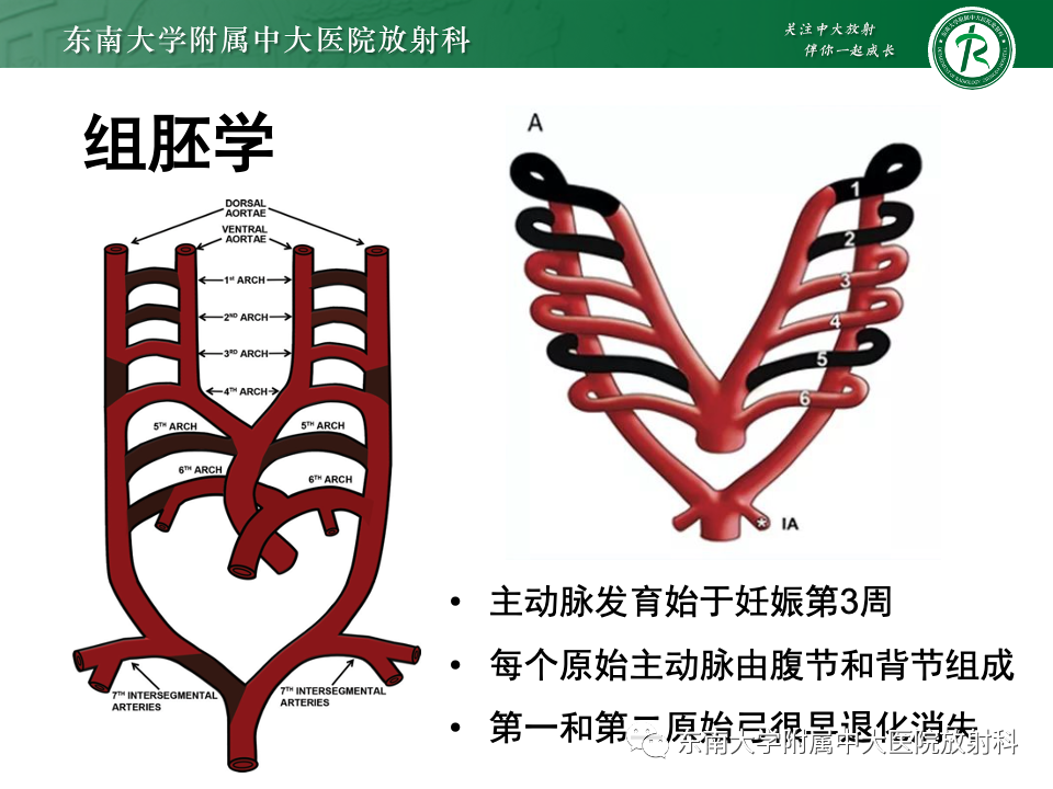 影像PPT - 【PPT】主动脉弓离断-10 影像PPT - 【PPT】主动脉弓离断-10