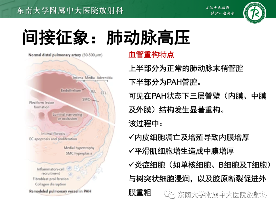 影像PPT - 【PPT】主动脉弓离断-30 影像PPT - 【PPT】主动脉弓离断-30
