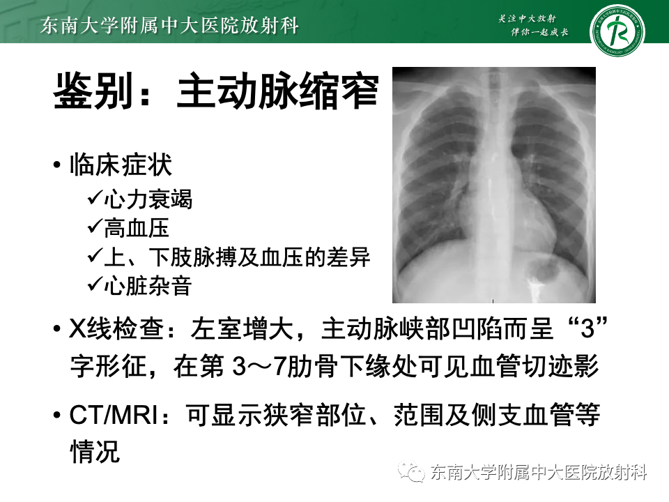 影像PPT - 【PPT】主动脉弓离断-34 影像PPT - 【PPT】主动脉弓离断-34