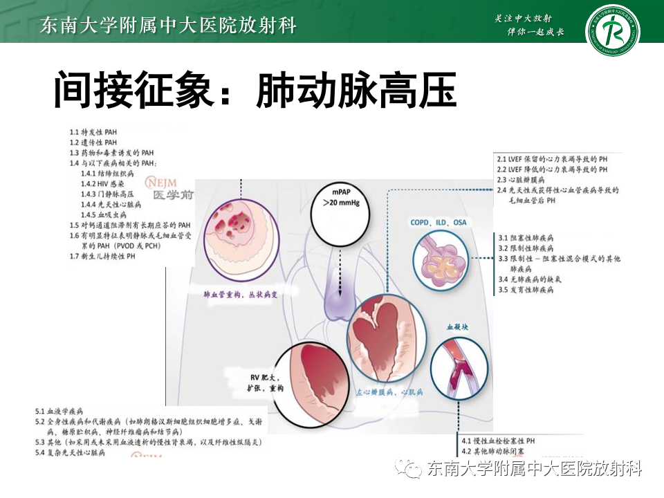 影像PPT - 【PPT】主动脉弓离断-29 影像PPT - 【PPT】主动脉弓离断-29