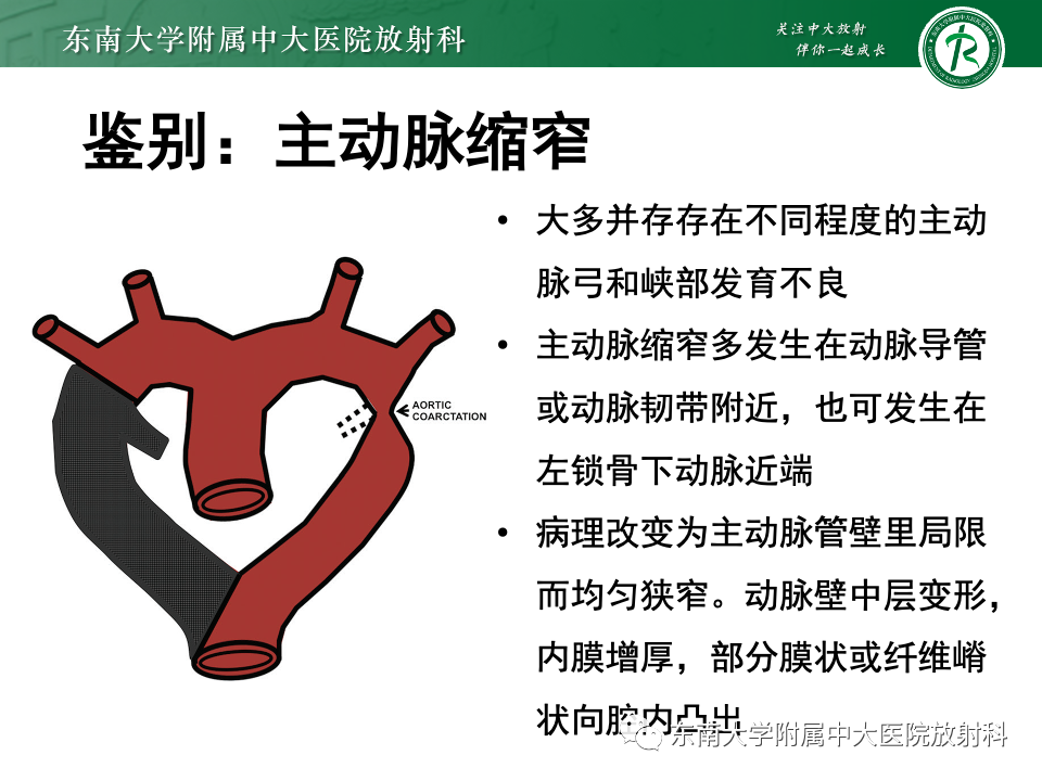 影像PPT - 【PPT】主动脉弓离断-32 影像PPT - 【PPT】主动脉弓离断-32