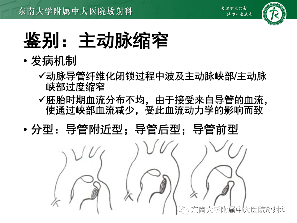 影像PPT - 【PPT】主动脉弓离断-33 影像PPT - 【PPT】主动脉弓离断-33