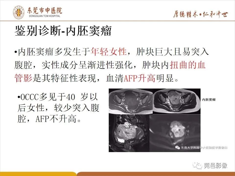 影像PPT - 【病例】卵巢透明细胞癌1例MR影像表现-32