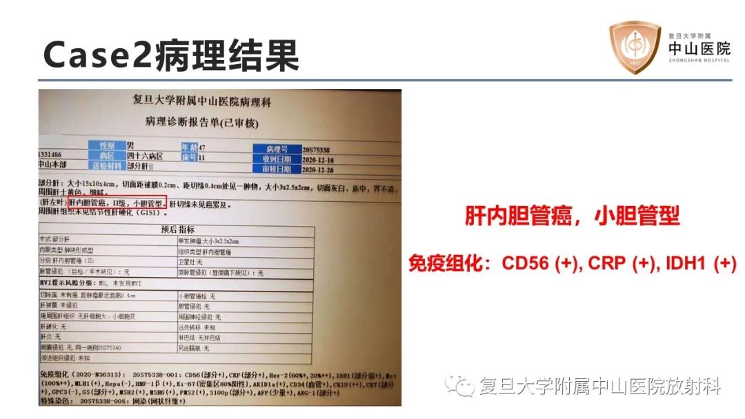 影像PPT - 【病例】肝内胆管细胞癌2例MR影像-8