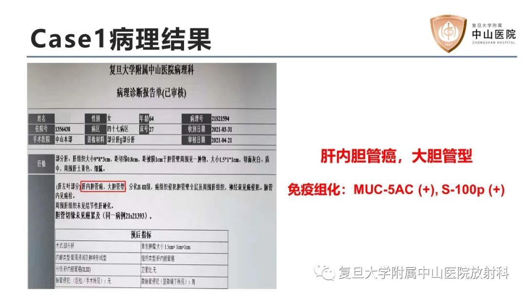 影像PPT - 【病例】肝内胆管细胞癌2例MR影像-7