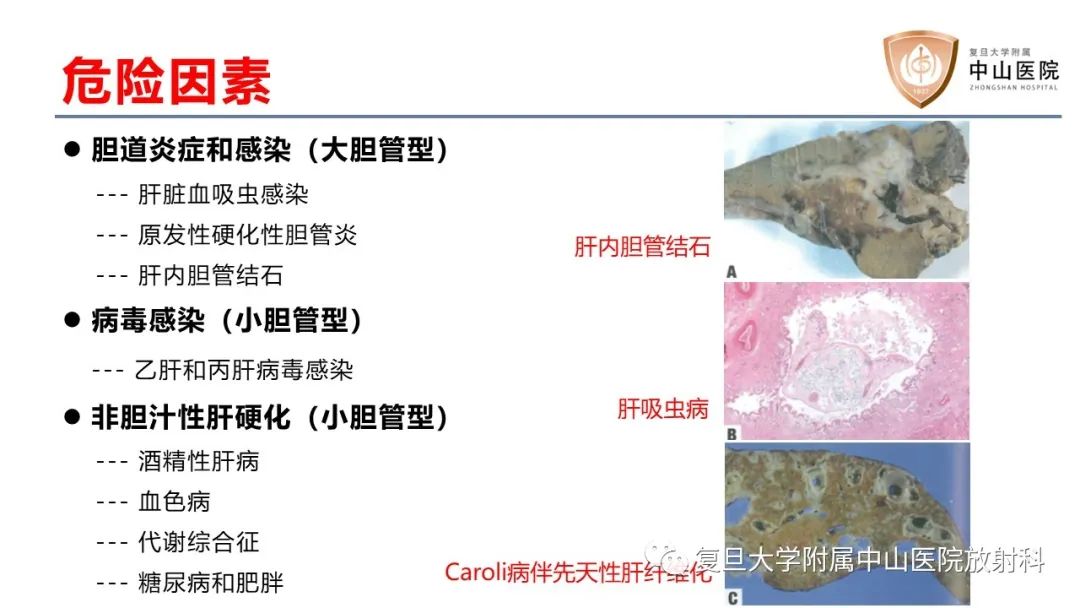 影像PPT - 【病例】肝内胆管细胞癌2例MR影像-19