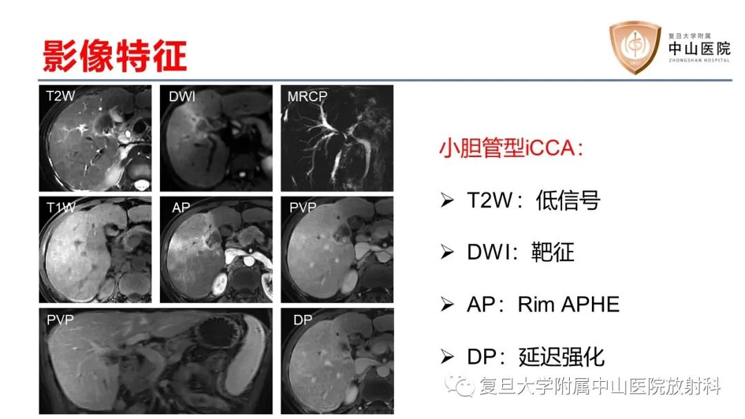 影像PPT - 【病例】肝内胆管细胞癌2例MR影像-24