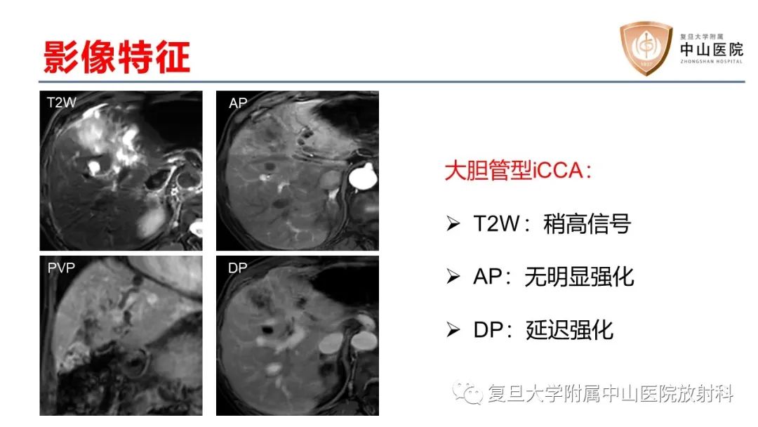 影像PPT - 【病例】肝内胆管细胞癌2例MR影像-25